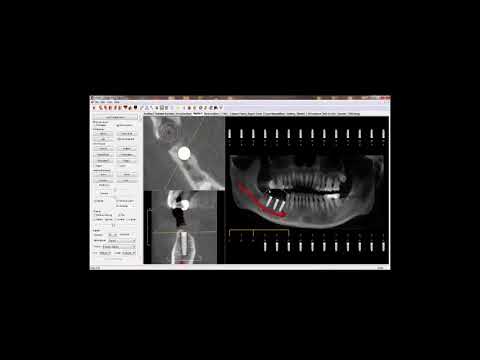 anatomage in vivo viewer