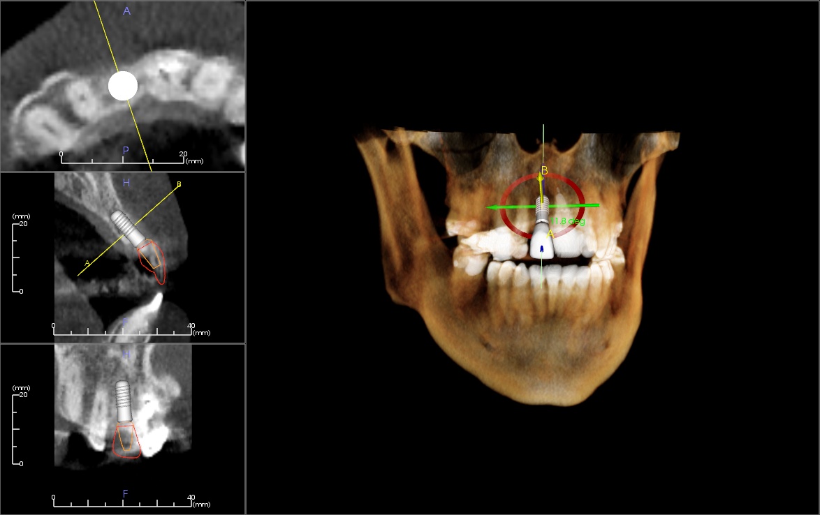 in vivo dental viewer download